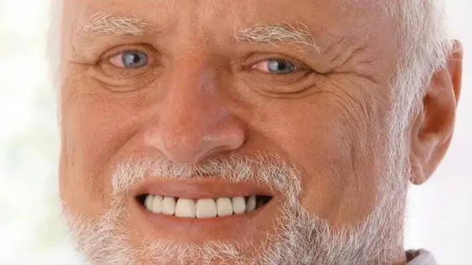 Hide the pain Harold